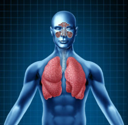 Overview: How Mesothelioma Develops from Asbestos Exposure