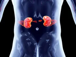 Prevacid-Prilosec-Nexium Lawsuit alleges PPIs caused Chronic Kidney Disease