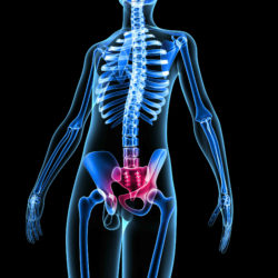 pelvic complications lead to Ethicon Gynemesh lawsuits