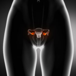 complications lead to Essure Hysterectomy
