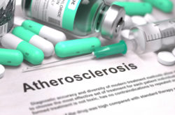 Tasigna Medication for Chronic Myeloid Leukemia Linked to Atherosclerosis