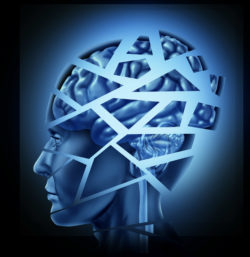 Dilantin has been connected with cerebellar degeneration