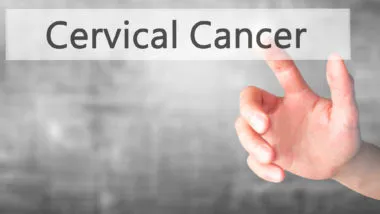 cervical cancer after hysterectomy
