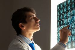 Dilantin Long Term Side Effects May Include Cerebellar Brain Atrophy