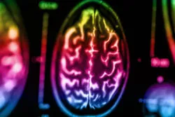 FDA Issues Warning Over Gadolinium Contrast Agents