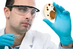 necrotizing fasciitis bacteria on slide