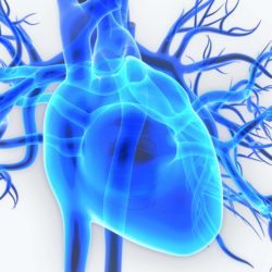 Gunther Tulip IVC filter lawsuit