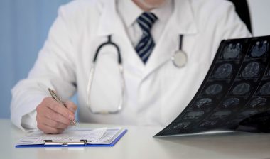 doctor looking at charts to determine if patient has cerebellar atrophy ataxia