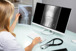 A doctor looking at a knee x-ray on a computer.