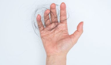 hand holding hair from chemotherapy hair loss