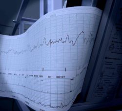 heart monitor readout on paper