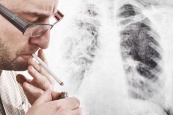 asbestos and lung cancer are tied to exposure