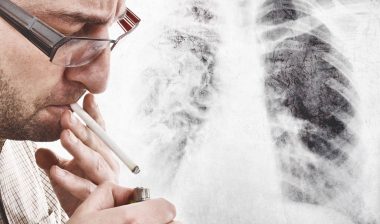 asbestos and lung cancer are tied to exposure