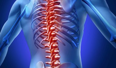 Transverse Myelitis Lawsuit Filed in Federal Court Over Shingles Vaccine