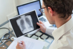 A doctor looks at a chest X-ray.