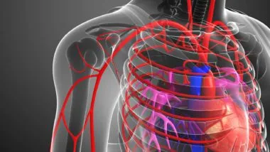fluoroquinolone antibiotics damage the aorta