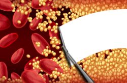 side effects of Pradaxa include bleeds