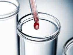 Xarelto injuries from blood thinner side effects