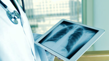 A doctor reviews a chest X-ray.