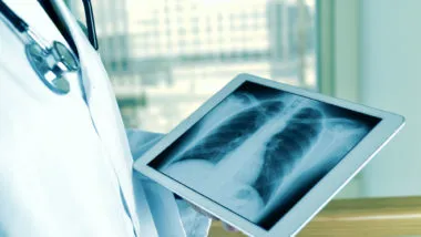 A doctor reviews a chest X-ray.