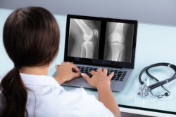 Doctor looks at a knee xray.