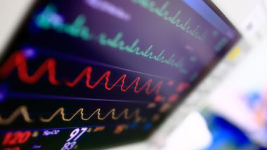 A heart monitor screen in a doctor's office