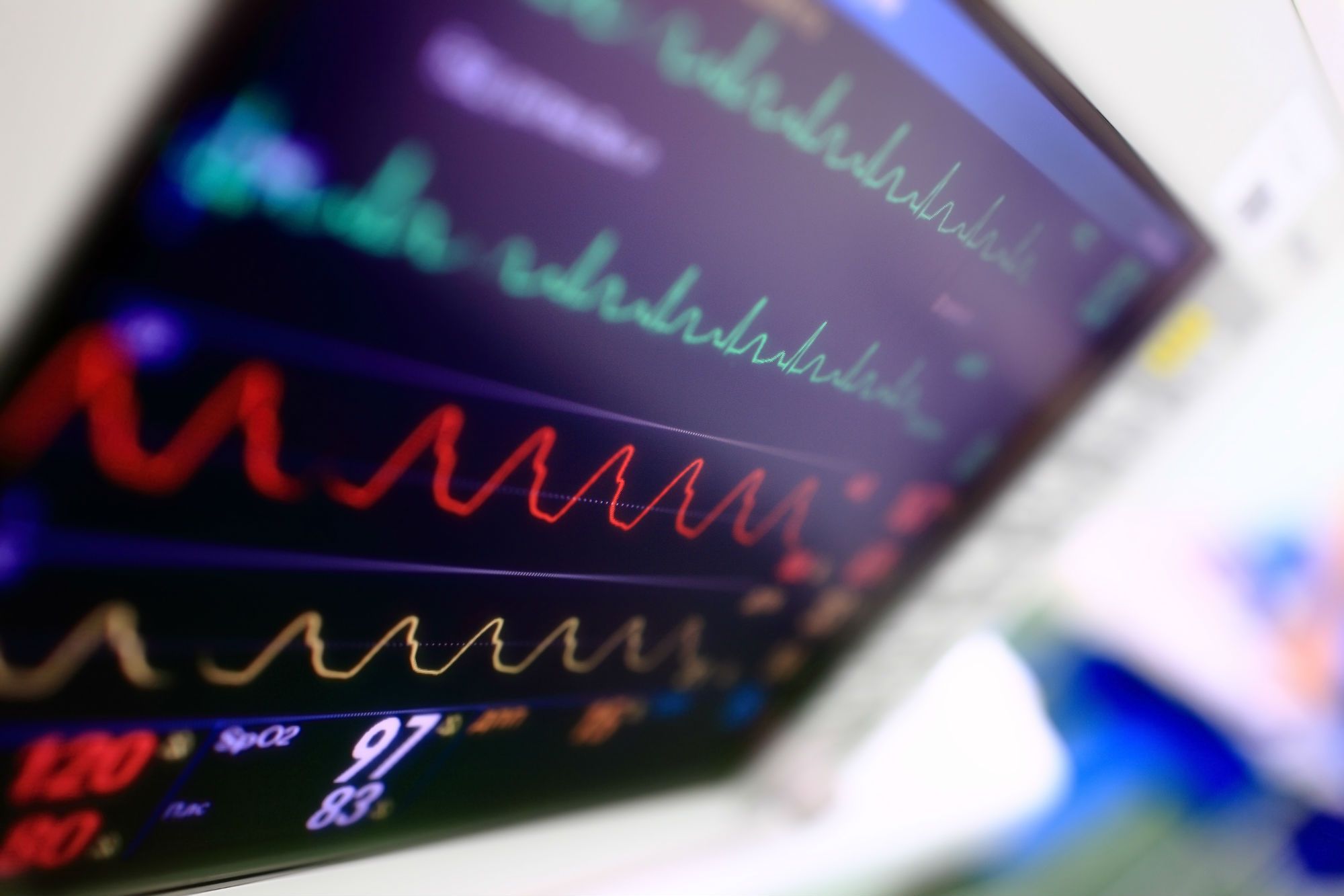A heart monitor screen in a doctor's office