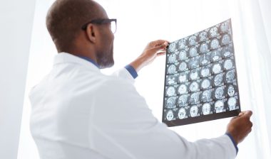 cerebellar-atrophy