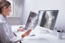 Doctor looks at a knee xray.