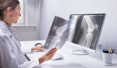 Doctor looks at a knee xray.