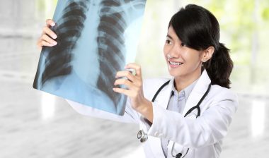 A doctor looks at a lung cancer xray.