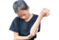 A girl scratches her elbow.