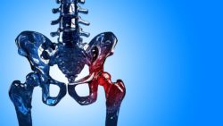 Hip of a skeleton on blue background