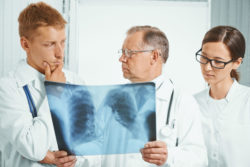 Three doctors look at a chest X-ray.
