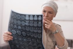 Chemotherapy woman with MRI