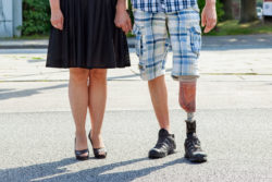 A woman and a man with a prosthetic leg