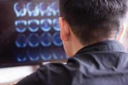Doctor looking at MRI images
