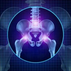 DePuy Hip Replacement Lawsuit