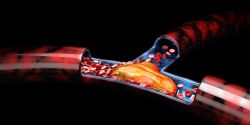 Xeljanz is prescribed for UC, but tied to blood clots