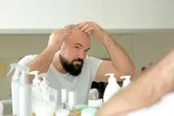 Adult man with hair loss