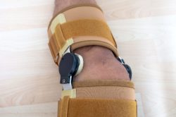 post Zimmer Persona knee replacement surgery