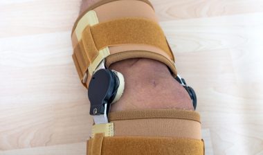 post Zimmer Persona knee replacement surgery