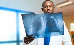 Doctor looking at lung xray