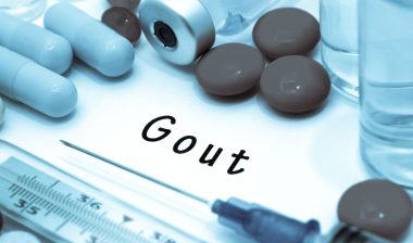 Gout surrounded by treatment options
