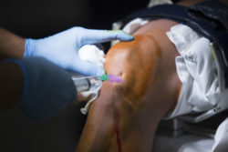knee-replacement-patient-has-procedure-for-second-time