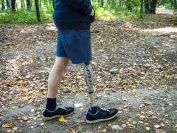 amputation in diabetics