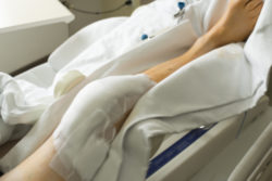 Knee arthroplasty surgery replaces knee joints with prostheses.