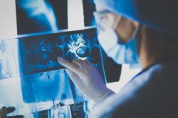 surgeon looking at asbestos mesothelioma xray