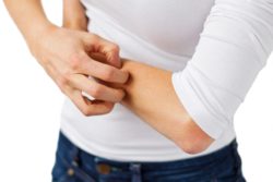 rash is a side effect of Lamictal