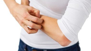 rash is a side effect of Lamictal